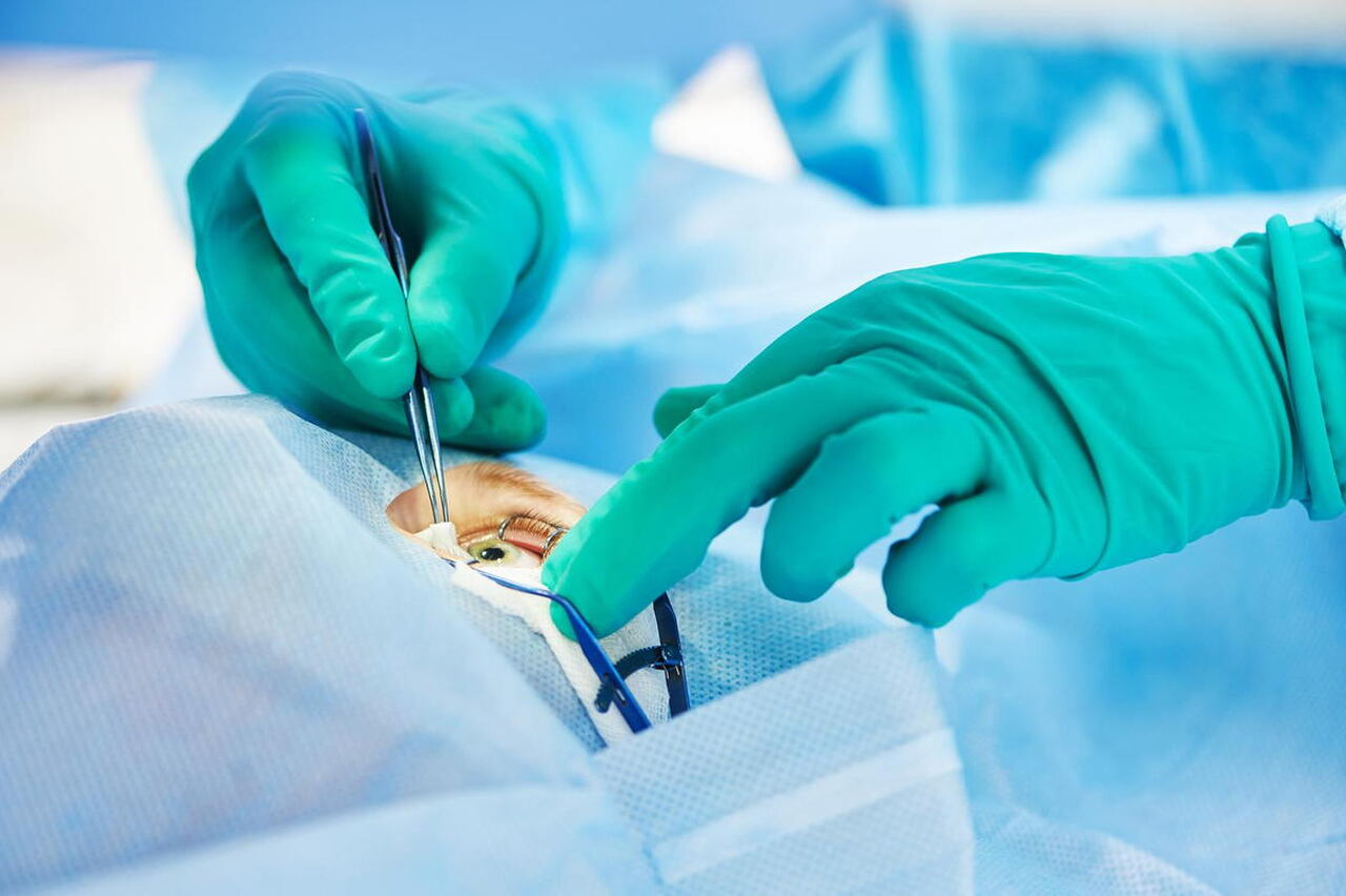 Entenda como é a cirurgia de estrabismo e tire suas dúvidas